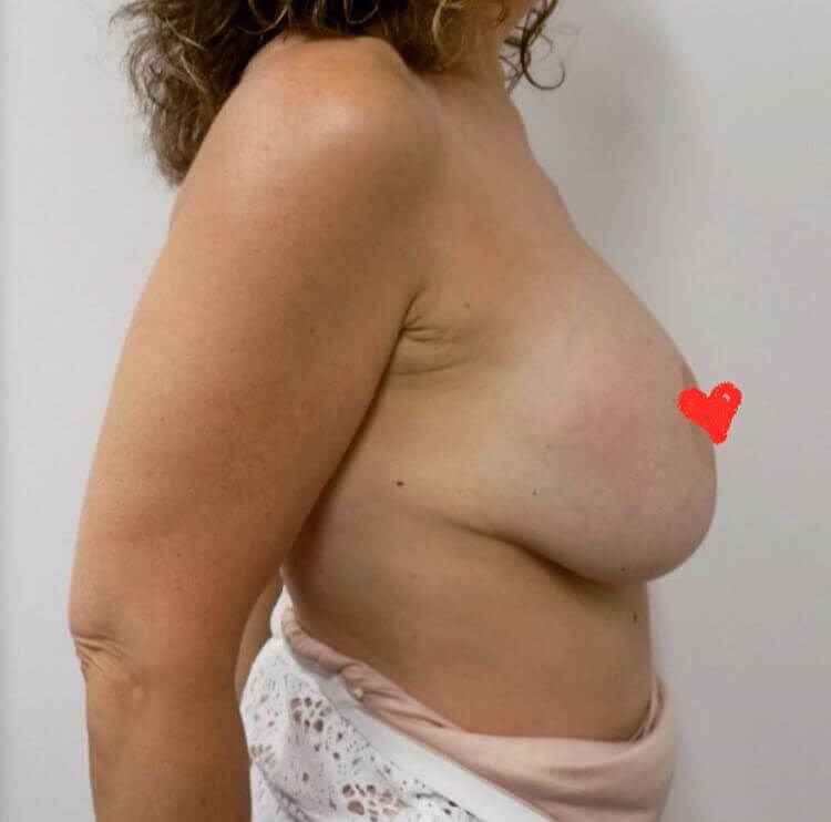 After Image