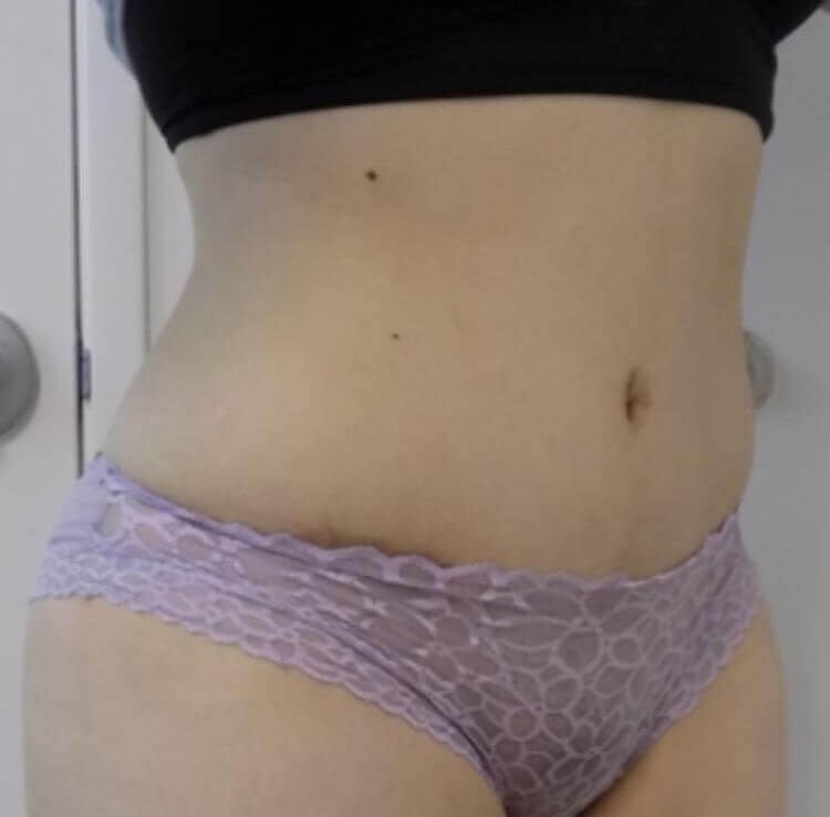After Image