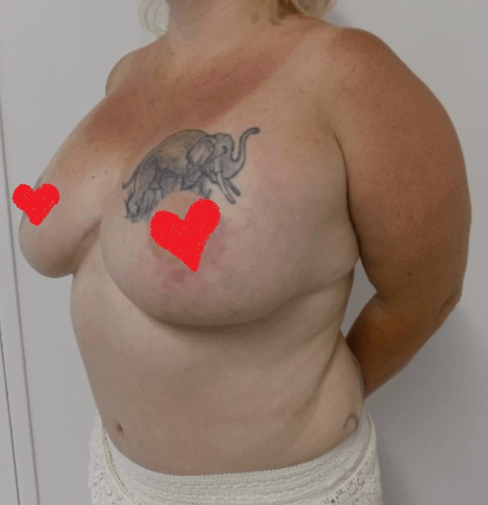 After Image