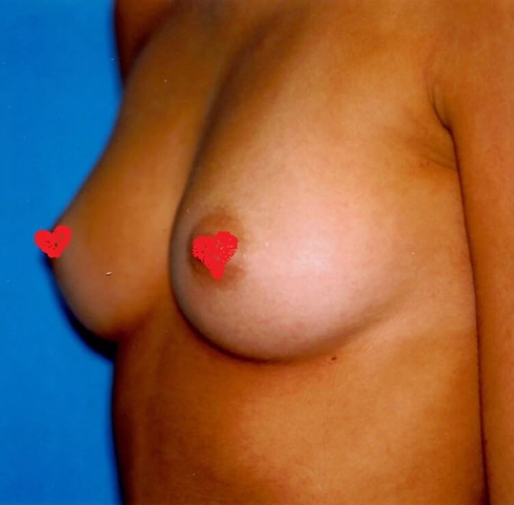 Before Image