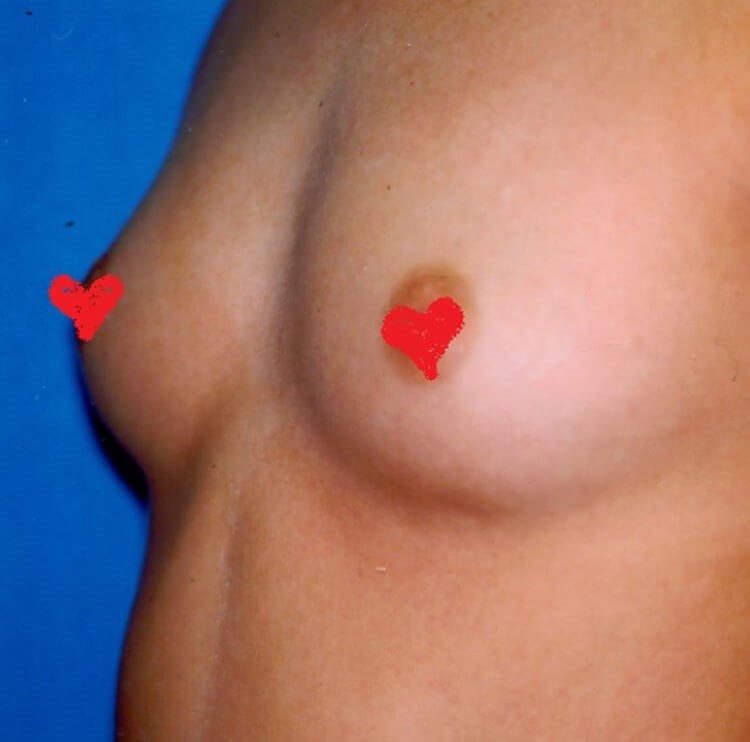 Before Image