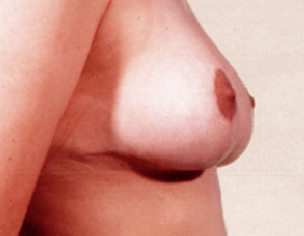 After Image
