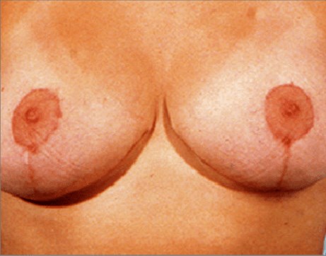 After Image