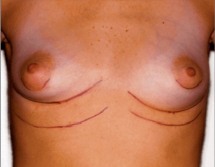 Before Image