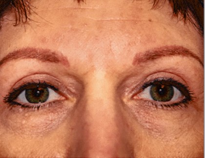 After Image