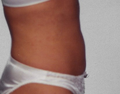 After Image