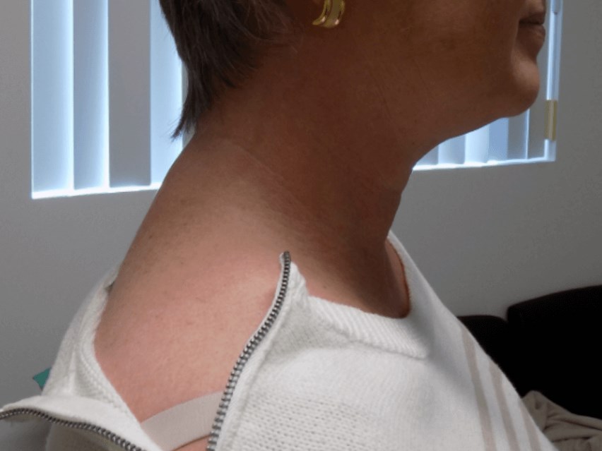 San Diego Buffalo Hump After